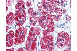 Anti-CAD antibody IHC of human adrenal. (CAD 抗体  (AA 1625-1900))