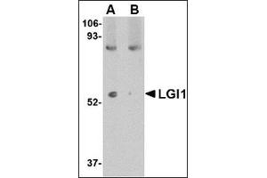 Western blot analysis of LGI1 in mouse brain tissue lysate with this product at 1 μg/ml in (A) the absence and (B) the presence of blocking peptide. (LGI1 抗体  (N-Term))