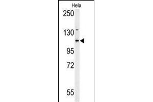 Western blot analysis of ADCY4 Antibody (Center)&65288,Cat(ABIN653832 and ABIN2843098)) in Hela cell line lysates (35 μg/lane). (ADCY4 抗体  (AA 415-441))