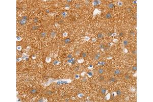Immunohistochemistry (IHC) image for anti-Synuclein, alpha (SNCA) antibody (ABIN2434303) (SNCA 抗体)