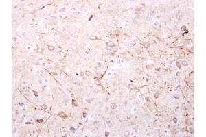 Immunohistochemistry (IHC) image for anti-Sepiapterin Reductase (SPR) antibody (ABIN2856918)