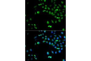 Immunofluorescence analysis of A549 cells using HOXA1 antibody (ABIN5974165). (HOXA1 抗体)