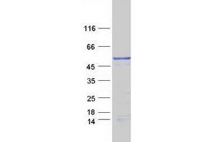 Western Blotting (WB) image for Melanoma Antigen Family B, 10 (MAGEB10) protein (Myc-DYKDDDDK Tag) (ABIN2725203)