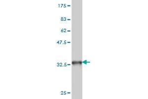 Western Blot detection against Immunogen (33. (Topoisomerase I 抗体  (AA 692-765))