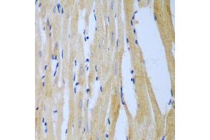 Immunohistochemistry of paraffin-embedded rat heart using MGAT3 antibody at dilution of 1:100 (40x lens). (MGAT3 抗体)