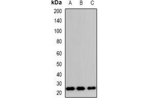 Western blot analysis of TP53INP2 expression in HeLa (A), RAW264. (TP53INP2 抗体  (N-Term))