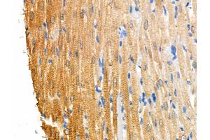 Phospho-RIPK3 (Ser199) Antibody at 1/100 staining Rat heart tissue by IHC-P. (RIPK3 抗体  (pSer199))