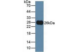 Detection of TIGIT in Rat Serum using Polyclonal Antibody to T-Cell Immunoreceptor With Ig And ITIM Domains Protein (TIGIT) (TIGIT 抗体  (AA 28-227))