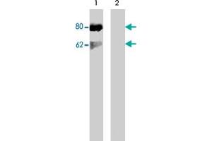 Western blot of Jurkat cells stimulated with calyculin A (100 nM, 30 min) (lane 1) followed by lambda phosphatase (lane 2) treatment. (DOK1 抗体  (pSer450))