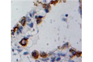 Used in DAB staining on fromalin fixed paraffin-embedded Ovary tissue (Cofilin 2 抗体  (AA 1-156))