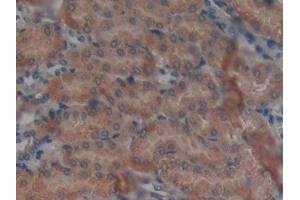 DAB staining on IHC-P; Samples: Mouse Kidney Tissue (GALNS 抗体  (AA 168-377))