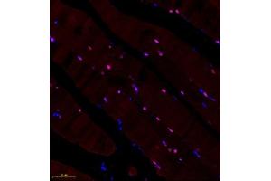 Immunofluorescence of paraffin embedded rat skeletal muscle using BCMA (ABIN7076067) at dilution of 1: 600 (250x lens) (BCMA 抗体)