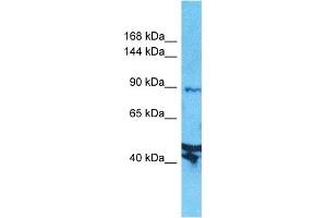Host:  Rabbit  Target Name:  AXIN2  Sample Type:  Jurkat Whole Cell lysates  Antibody Dilution:  1. (AXIN2 抗体  (N-Term))