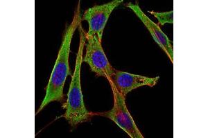 Immunofluorescence analysis of NIH/3T3 cells using FGG mouse mAb (green). (FGG 抗体)