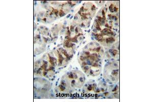 CTGF Antibody (Center) (ABIN657322 and ABIN2846396) immunohistochemistry analysis in formalin fixed and paraffin embedded human stomach tissue followed by peroxidase conjugation of the secondary antibody and DAB staining. (CTGF 抗体  (AA 166-193))