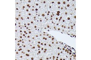 Immunohistochemistry of paraffin-embedded mouse liver using Phospho-NRF2-S40 Rabbit mAb (ABIN7268970) at dilution of 1:100 (40x lens). (NRF2 抗体  (pSer40))