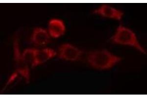 ABIN6275813 staining COLO205 cells by IF/ICC. (Cytochrome P450 4A11/22 抗体)