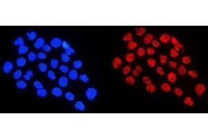 IF analysis of HnRNP A1 using anti-HnRNP A1 antibody (ABIN4886621). (HNRNPA1 抗体  (N-Term))