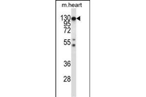 Western Blotting (WB) image for anti-Colony Stimulating Factor 1 Receptor (CSF1R) (AA 895-923), (C-Term) antibody (ABIN657832)