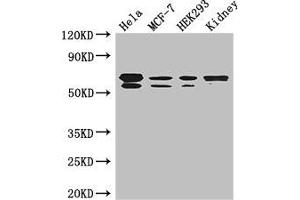 Western Blot Positive WB detected in: Hela whole cell lysate, MCF-7 whole cell lysate, HEK293 whole cell lysate, Mouse kidney tissue All lanes: RBPJ antibody at 3. (RBPJ 抗体  (AA 243-485))