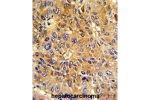 Immunohistochemistry (IHC) image for anti-Cyclin A2 (CCNA2) antibody (ABIN3003117) (Cyclin A 抗体)