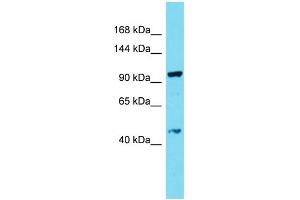 Host: Rabbit Target Name: CCDC135 Sample Type: THP-1 Whole Cell lysates Antibody Dilution: 1. (CCDC135 抗体  (C-Term))