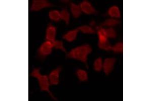 ABIN6269180 staining COS7 by IF/ICC. (Phospholipase C gamma 1 抗体)