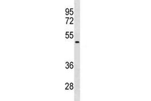 NEU1 antibody western blot analysis in HepG2 lysate. (NEU1 抗体  (AA 188-214))