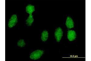 Immunofluorescence of purified MaxPab antibody to RPLP0 on HeLa cell. (RPLP0 抗体  (AA 1-317))