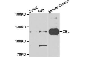Western blot analysis of extracts of various cell lines, using CBL antibody (ABIN5995395) at 1/1000 dilution. (CBL 抗体)