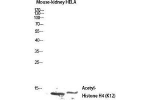 Western Blot (WB) analysis of Mouse Kidney HeLa lysis using Acetyl-Histone H4 (K12) antibody. (Histone H4 抗体  (acLys12))