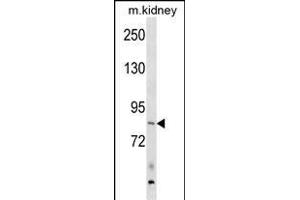 ARHGEF16 Antibody (N-term) (ABIN1881069 and ABIN2838779) western blot analysis in mouse kidney tissue lysates (35 μg/lane).