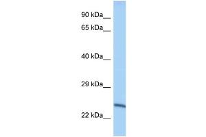 WB Suggested Anti-Mettl10 Antibody Titration: 1. (METTL10 抗体  (Middle Region))