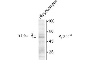 Western blots of hippocampal lysate showing specific immunolabeling of the ~50k TR-a1 and the ~58k TR-a2 protein. (THRA 抗体  (N-Term))