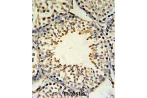 Immunohistochemistry (Paraffin-embedded Sections) (IHC (p)) image for anti-Acyl-CoA Synthetase Bubblegum Family Member 2 (ACSBG2) (AA 244-273), (Middle Region) antibody (ABIN950254)