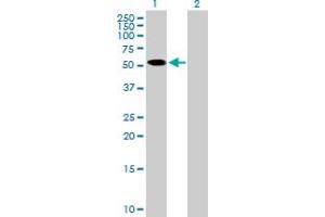 Western Blot analysis of ZNF410 expression in transfected 293T cell line by ZNF410 MaxPab polyclonal antibody. (ZNF410 抗体  (AA 1-478))