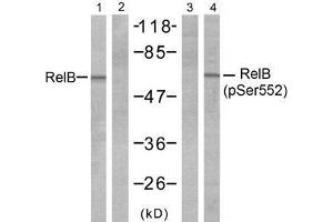 Western blot analysis of extracts from A431 cells, untreated or treated with EGF (200ng/ml 10min), using RelB (Ab-552) antibody (E021247, Line 1 and 2) and RelB (phospho- Ser552) antibody (E011255, Line 3 and 4). (RELB 抗体  (pSer552))