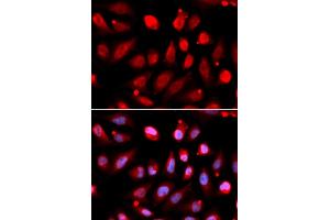 Immunofluorescence analysis of U2OS cells using EZH2/KMT6 antibody (ABIN6133509, ABIN6140393, ABIN6140396 and ABIN6215059). (EZH2 抗体  (AA 1-250))