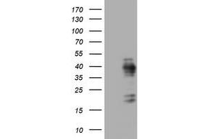 Image no. 1 for anti-Antigen Identified By Monoclonal Antibody Ki-67 (MKI67) (AA 1160-1493) antibody (ABIN1490860) (Ki-67 抗体  (AA 1160-1493))