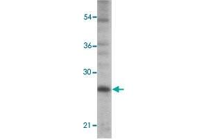 Western blot analysis of PC-3 cells with TICAM2 polyclonal antibody  at 1 ug/mL dilution.