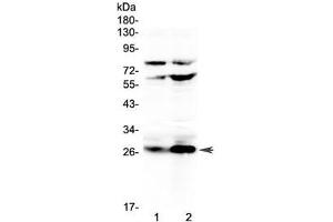 Western blot testing of rat 1) RH35 and 2) PC-12 cell lysate with Factor D antibody at 0. (Adipsin 抗体  (AA 26-263))