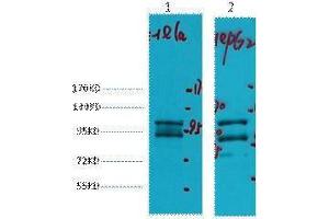 Western Blotting (WB) image for anti-Insulin-Degrading Enzyme (IDE) antibody (ABIN3178636) (IDE 抗体)