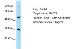 Image no. 1 for anti-Myc Target 1 (MYCT1) (AA 95-144) antibody (ABIN6750014) (Myc Target 1 抗体  (AA 95-144))