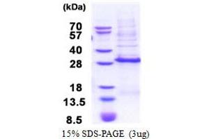 SDS-PAGE (SDS) image for Distal-Less Homeobox 3 (DLX3) (AA 1-186) protein (His tag) (ABIN5853443) (DLX3 Protein (AA 1-186) (His tag))