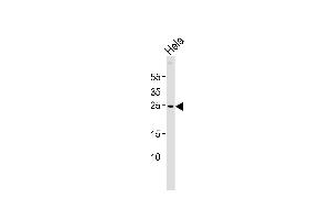 Western blot analysis of lysate from Hela cell line, using ZNRF2 Antibody (N-term) (ABIN6242713 and ABIN6577528). (ZNRF2 抗体  (N-Term))