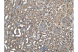 Immunohistochemistry (IHC) image for anti-Ewing Sarcoma Breakpoint Region 1 (EWSR1) (Internal Region) antibody (ABIN335135)