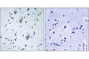 Immunohistochemistry analysis of paraffin-embedded human brain tissue, using FZD6 Antibody. (FZD6 抗体  (AA 116-165))