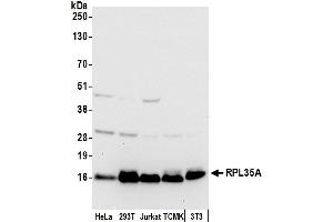 anti-Ribosomal Protein L35a (RPL35A) (AA 60-110) antibody
