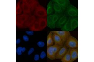 NIPA2 Mouse Monoclonal Antibody staining Hela cells by IF/ICC. (NIPA2 抗体)