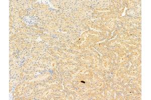 ABIN6263730 and ABIN6266924 at 1/100 staining Rat kidney tissue by IHC-P. (NRF2 抗体  (N-Term))